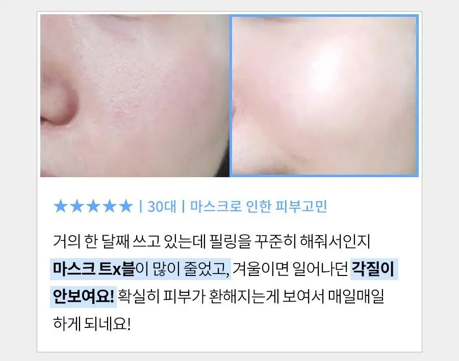[피지제거/필링] 페이스팩토리 제트 필링기 상세페이지 12